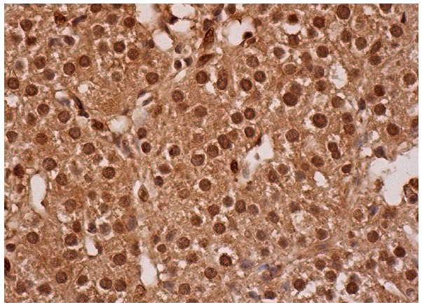 Exo84 (C-16): sc-160319. Immunoperoxidase staining of formalin fixed, paraffin-embedded human adrenal gland tissue showing cytoplasmic and nuclear staining of glandular cells.
