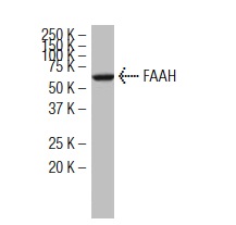 FAAH (27-Y): sc-100739. Western blot analysis of FAAH expression in A-431 whole cell lysate.