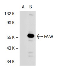 FAAH (27-Y): sc-100739. Western blot analysis of FAAH expression in non-transfected: sc-117752 (A) and human FAAH transfected: sc-112472 (B) 293T whole cell lysates.