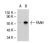 FAAH (27-Y): sc-100739. Western blot analysis of FAAH expression in non-transfected: sc-117752 (A) and mouse FAAH transfected: sc-125318 (B) 293T whole cell lysates.