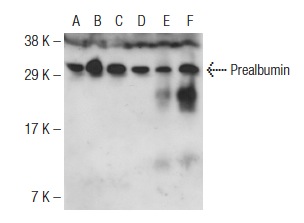 Prealbumin (FL-147): sc-13098. Western blot analysis of Prealbumin expression in Hep G2 (A), ARPE-19 (B), H4 (C) and SK-N-MC (D) whole cell lysates and mouse liver (E) and mouse brain (F) tissue extracts.
