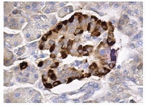 Prealbumin (FL-147): sc-13098. Immunoperoxidase staining of formalin fixed, paraffin-embedded human pancreas tissue showing cytoplasmic staining of Islets of Langerhans.
