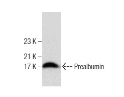 Prealbumin (FL-147): sc-13098. Western blot analysis of Prealbumin in human plasma.