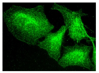 FANCL (H-8): sc-137068. Immunofluorescence staining of formalin-fixed Hep G2 cells showing nuclear and cytoplasmic localization.