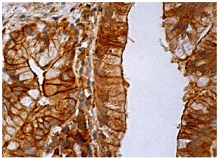 FANCL (H-8): sc-137068. Immunoperoxidase staining of formalin fixed, paraffin-embedded human gall bladder tissue showing cytoplasmic and membrane staining of glandular cells.