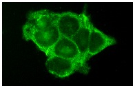 FTα (C-19): sc-487. Immunofluorescence staining of methanol-fixed A-431 cells showing cytoplasmic staining.