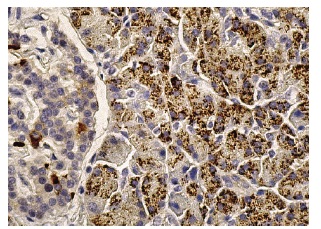 Furin (H-220): sc-20801. Immunoperoxidase staining of formalin fixed, paraffin-embedded human pancreas tissue showing cytoplasmic staining of glandular cells.
