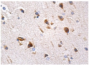 Furin (B-6): sc-133142. Immunoperoxidase staining of formalin fixed, paraffin-embedded human brain tissue showing cytoplasmic staining of neuronal and glial cells.
