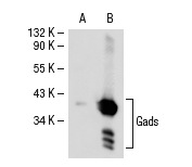 Gads (UW40): sc-73652. Western blot analysis of Gads expression in non-transfected: sc-117752 (A) and human Gads transfected: sc-114137 (B) 293T whole cell lysates.