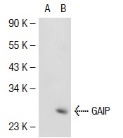 GAIP (N-17): sc-6208. Western blot analysis of GAIP expression in non-transfected: sc-117752 (A) and mouse GAIP transfected: sc-126884 (B) 293T whole cell lysates.