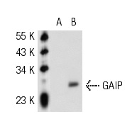 GAIP (N-17): sc-6208. Western blot analysis of GAIP expression in non-transfected: sc-117752 (A) and human GAIP transfected: sc-116813 (B) 293T whole cell lysates.