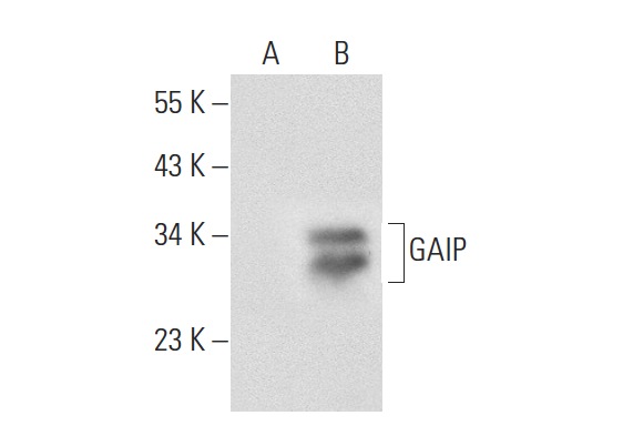 GAIP (N-17): sc-6208. Western blot analysis of GAIP expression in non-transfected: sc-117752 (A) and human GAIP transfected: sc-159994 (B) 293T whole cell lysates.