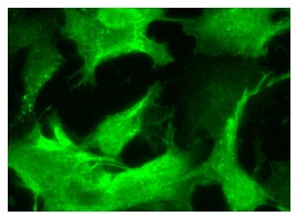 GAPDH (G-9): sc-365062. Immunofluorescence staining of formalin-fixed Hep G2 cells showing cytoplasmic localization.
