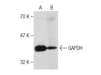 GAPDH (G-9): sc-365062. Western blot analysis of GAPDH expression in KNRK whole cell lysate (A) and mouse liver tissue extract (B).