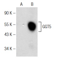GGT5 (F-8): sc-373693. Western blot analysis of GGT5 expression in non-transfected: sc-110760 (A) and human GGT5 transfected: sc-111560 (B) 293 whole cell lysates.