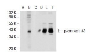 Western blot analysis of connexin 43 phosphorylation in untreated (A, D), PMA treated (B, E) and PMA and lambda protein phosphatase treated (C, F) HEK293 whole cell lysates. Antibodies tested include p-connexin 43 (Ser 279/282)-R: sc-12900-R (A, B, C) and connexin 43 (C-20)-R: sc-6560-R (D, E, F).