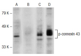 Western blot analysis of connexin 43 phosphorylation in untreated (A,C) and lambda protein phosphatase (sc-200312A) treated (B,D) F9 whole cell lysates. Antibodies tested include p-connexin 43 (Ser 279/282)-R: sc-12900-R (A,B) and connexin 43 (C-20)-R: sc-6560-R (C,D).