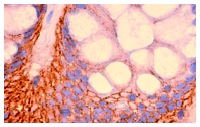 Ep-CAM (C-10): sc-25308. Immunoperoxidase staining of formalin fixed, paraffin-embedded human colon tissue showing membrane localization.