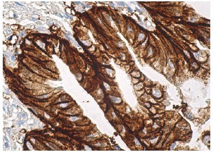 Ep-CAM (C-10): sc-25308. Immunoperoxidase staining of formalin fixed, paraffin-embedded human gall bladder tissue showing membrane staining of glandular cells.
