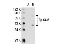 Ep-CAM (323/A3): sc-73491. Western blot analysis of Ep-CAM expression in non-transfected: sc-117752 (A) and human Ep-CAM transfected: sc-113013 (B) 293T whole cell lysates.