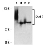 ICAM-3 (186.2G9): sc-65269. Western blot analysis of ICAM-3 expression in Jurkat (A), U-698 (B), U-937 (C), HuT 78 (D) and Ramos (E) whole cell lysates.