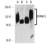 ICAM-3 (CG106): sc-53338. Western blot analysis of ICAM-3 expression in HL-60 (A), Jurkat (B), CCRF-CEM (C) and human PBL (D) whole cell lysates under non-reducing conditions.