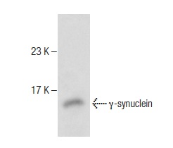 γ-synuclein (1H10D2): sc-65979. Western blot analysis of γ-synuclein expression in MIA PaCa-2 whole cell lysate.