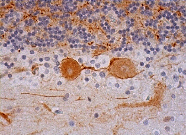 γ-synuclein (1H10D2): sc-65979. Immunoperoxidase staining of formalin fixed, paraffin-embedded human cerebellum tissue showing cytoplasmic and membrane staining of Purkinje cells and cytoplasmic staining of cells in granular layer and cells in molecular layer.