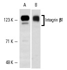 Integrin β1 (N-20): sc-6622. Western blot analysis of Integrin β1 expression in SK-N-SH (A) and U-87 MG (B) whole cell lysates.
