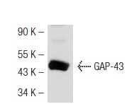 GAP-43 (7B10): sc-33705. Western blot analysis of GAP-43 expression in mouse brain tissue extract.