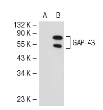 GAP-43 (7B10): sc-33705. Western blot analysis of GAP-43 expression in non-transfected: sc-117752 (A) and human GAP-43 transfected: sc-175907 (B) 293T whole cell lysates.