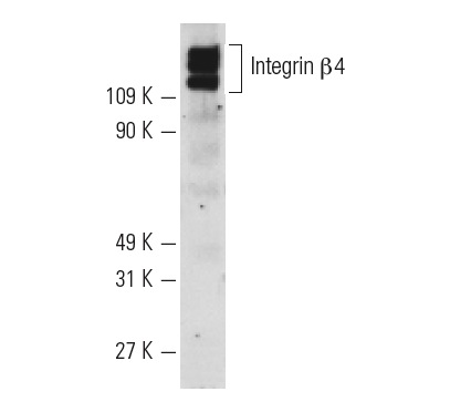 Integrin β4 (H-101): sc-9090. Western blot analysis of Integrin β4 expression in SW480 whole cell lysate.