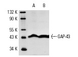 GAP-43 (C-19): sc-7457. Western blot analysis of GAP-43 expression in rat cerebellum (A) and mouse brain (B) tissue extracts.