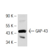 GAP-43 (C-19): sc-7457. Western blot analysis of GAP-43 expression in mouse brain tissue extract.