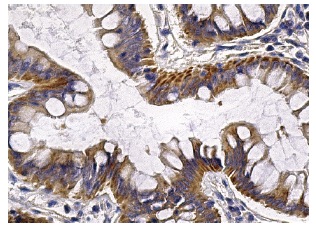 JAM-A (H-80): sc-25629. Immunoperoxidase staining of formalin fixed, paraffin-embedded human colon tissue showing cytoplasmic and membrane staining of glandular cells.