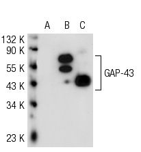 GAP-43 (C-19): sc-7457. Western blot analysis of GAP-43 expression in non-transfected: sc-117752 (A) and human GAP-43 transfected: sc-175907 (B) 293T whole cell lysates and mouse brain tissue extract (C).