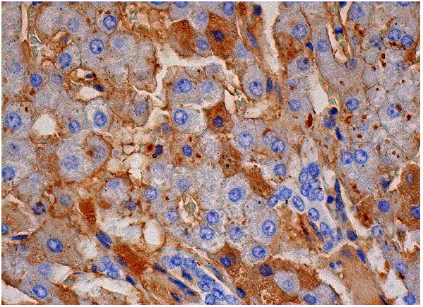 JAM-A (J3F.1): sc-53622. Immunoperoxidase staining of formalin fixed, paraffin-embedded human liver tissue showing membrane and cytoplasmic staining of hepatocytes.