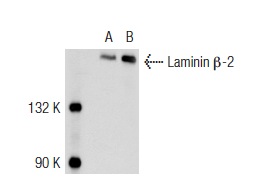Laminin β-2 (C4): sc-59980. Western blot analysis of Laminin β-2 expression in non-transfected: sc-117752 (A) and mouse Laminin β-2 transfected: sc-121282 (B) 293T whole cell lysates.