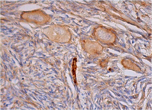 Laminin β-2 (C4): sc-59980. Immunoperoxidase staining of formalin fixed, paraffin-embedded human ovary tissue showing cytoplasmic staining of follicle cells and cytoplasmic and membrane staining of ovarian stroma cells.