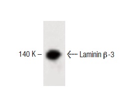 Laminin β-3 (17): sc-135968. Western blot analysis of Laminin β-3 expression in human endothelial whole cell lysate.