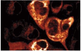 Laminin β-3 (17): sc-135968. Immunofluorescence staining of A-431 cells showing cytoplasmic localization.