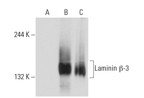 Laminin β-3 (17): sc-135968. Western blot analysis of Laminin β-3 expression in non-transfected 293T: sc-117752 (A), human Laminin β-3 transfected 293T: sc-177458 (B) and A-431 (C) whole cell lysates.