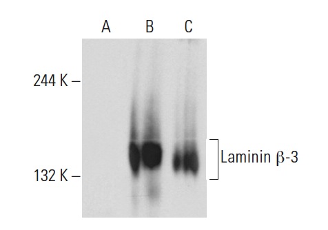 Laminin β-3 (17): sc-135968. Western blot analysis of Laminin β-3 expression in non-transfected 293T: sc-117752 (A), human Laminin β-3 transfected 293T: sc-177459 (B) and A-431 (C) whole cell lysates.