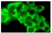 Laminin-R (F-18): sc-21534. Immunofluorescence staining of methanol-fixed Hep G2 cells showing cytoplasmic localization.