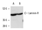 Laminin-R (F-18): sc-21534. Western blot analysis of Laminin-R expression in non-transfected: sc-117752 (A) and human Laminin-R transfected: sc-113628 (B) 293T whole cell lysates.