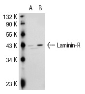 Laminin-R (F-18): sc-21534. Western blot analysis of Laminin-R expression in non-transfected: sc-117752 (A) and human Laminin-R transfected: sc-116343 (B) 293T whole cell lysates.