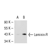 Laminin-R (F-18): sc-21534. Western blot analysis of Laminin-R expression in non-transfected: sc-117752 (A) and human Laminin-R transfected: sc-117344 (B) 293T whole cell lysates.