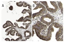 Laminin-R (H-141): sc-20979. Immunoperoxidase staining of formalin fixed, paraffin-embedded human gall bladder tissue showing cytoplasmic staining of glandular cells at low (A) and high (B) magnification. Kindly provided by The Swedish Human Protein Atlas (HPA) program.