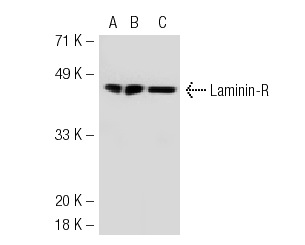 Laminin-R (H-141): sc-20979. Western blot analysis of Laminin-R expression in non-transfected 293T: sc-117752 (A), human Laminin-R transfected 293T: sc-116343 (B) and Hep G2 (C) whole cell lysates.