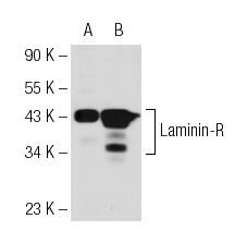 Laminin-R (H-141): sc-20979. Western blot analysis of Laminin-R expression in non-transfected: sc-117752 (A) and human Laminin-R transfected: sc-116343 (B) 293T whole cell lysates.